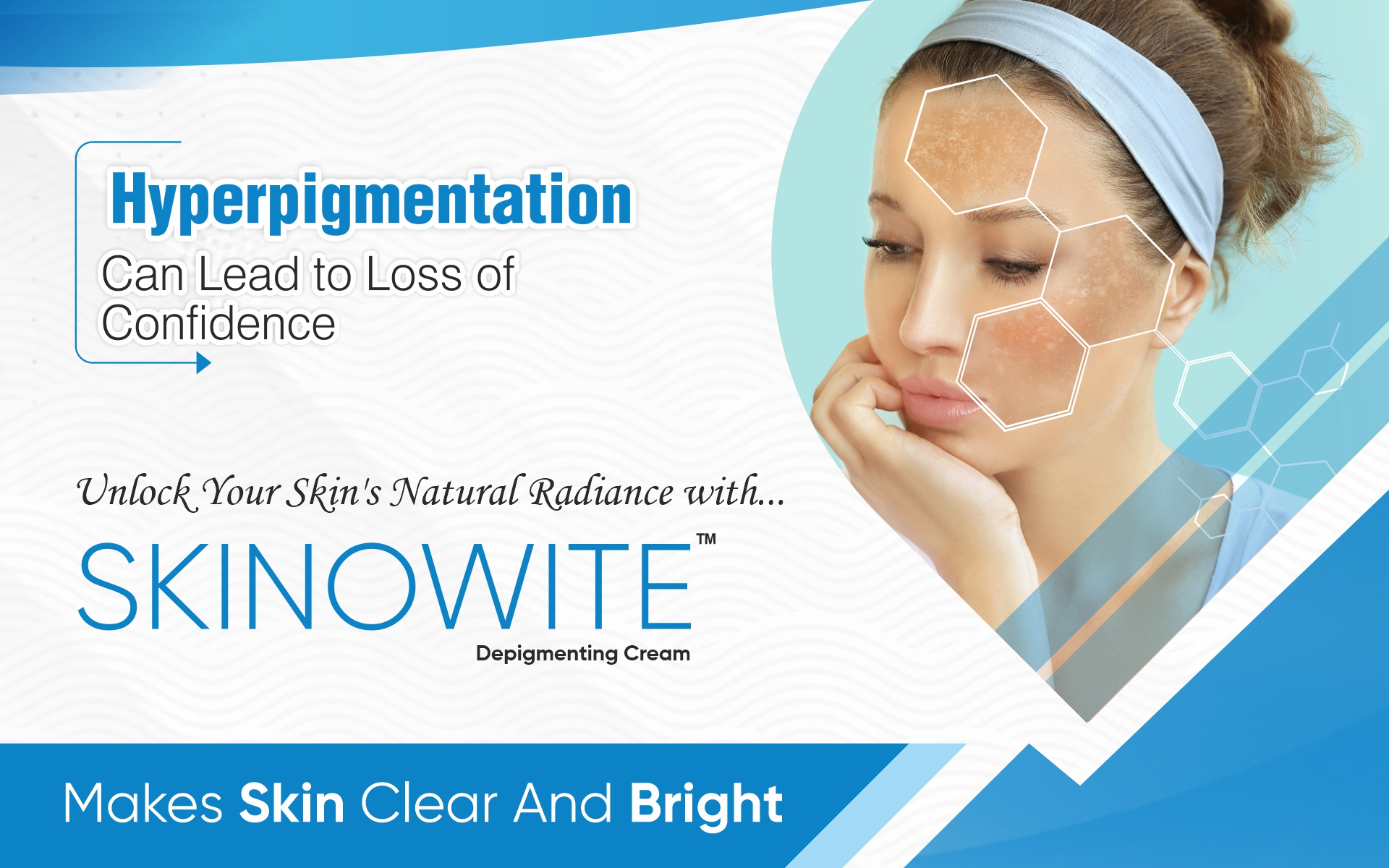 Skinowite Depigmenting Cream